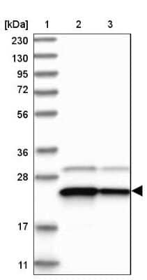 Western Blot: Use1/UBE2Z Antibody [NBP1-82785] - Lane 1: Marker [kDa] 230, 130, 95, 72, 56, 36, 28, 17, 11Lane 2: Human cell line RT-4Lane 3: Human cell line U-251MG sp