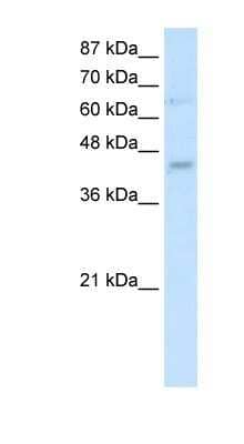 Western Blot: Use1/UBE2Z Antibody [NBP1-91539] - SP2/0 cell lysate, concentration 2.5 ug/ml.