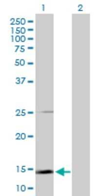 Western Blot: Uteroglobin/SCGB1A1 Antibody [H00007356-D01P] - Analysis of SCGB1A1 expression in transfected 293T cell line by SCGB1A1 polyclonal antibody.Lane 1: SCGB1A1 transfected lysate(10.00 KDa).Lane 2: Non-transfected lysate.