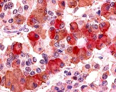 Immunohistochemistry-Paraffin V1b Vasopressin R/AVPR1B Antibody - BSA Free
