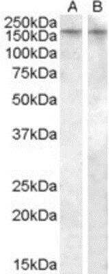 Western Blot: V1b Vasopressin R/AVPR1B Antibody [NBP1-20893] - Analysis of AVPR1B (mouse) in Human Amygdala lysate (35ug protein in RIPA buffer) in lane A and EB08786 (005ug/ml) staining of Rat Brain lysate (35ug protein in RIPA buffer) in lane B using this antibody at 0.5ug/ml. Primary incubation was 1 hour. Detected by chemiluminescence.