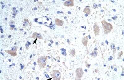 Immunohistochemistry: VABP Antibody [NBP2-88563] - Human Brain