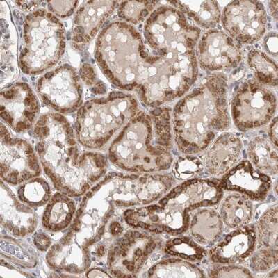 Immunohistochemistry-Paraffin: VABP Antibody [NBP1-81560] - Staining of human kidney shows strong cytoplasmic positivity in cells of tubules.