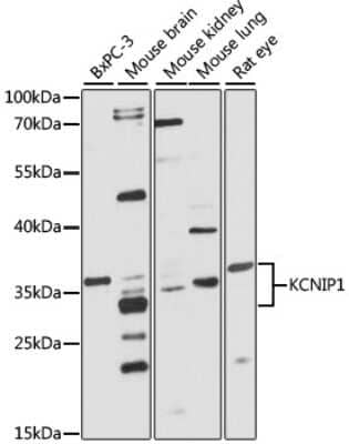 Western Blot: VABP Antibody [NBP2-93221] - Analysis of extracts of various cell lines, using VABP at 1:1000 dilution.Secondary antibody: HRP Goat Anti-Rabbit IgG (H+L) at 1:10000 dilution.Lysates/proteins: 25ug per lane.Blocking buffer: 3% nonfat dry milk in TBST.Detection: ECL Basic Kit .Exposure time: 30s.