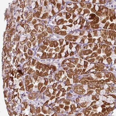Immunohistochemistry-Paraffin: VAM1 Antibody [NBP1-87364] - Staining of human stomach, upper shows strong cytoplasmic positivity in glandular cells.