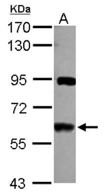 Western Blot: VAM1 Antibody [NBP2-15157] - Sample (30 ug of whole cell lysate) A: NT2D1 7.5% SDS PAGE; antibody diluted at 1:1000.
