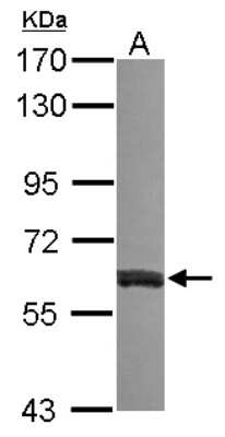 Western Blot: VAM1 Antibody [NBP2-15158] - Sample (30 ug of whole cell lysate) A: NT2D1 7.5% SDS PAGE, antibody diluted at 1:2000.