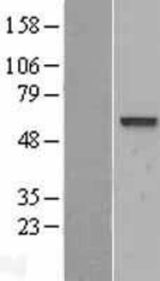 Western Blot: VAM1 Overexpression Lysate (Adult Normal) [NBL1-13205] Left-Empty vector transfected control cell lysate (HEK293 cell lysate); Right -Over-expression Lysate for VAM1.