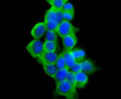 Immunocytochemistry: VAMP-1 Antibody (JG40-19) [NBP2-76877] - ICC staining VAMP1 in 293T cells (green). The nuclear counter stain is DAPI (blue). Cells were fixed in paraformaldehyde, permeabilised with 0.25% Triton X100/PBS.