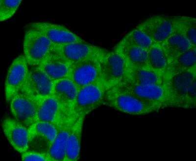 Immunocytochemistry: VAMP-1 Antibody (JG40-19) [NBP2-76877] - ICC staining VAMP1 in Hela cells (green). The nuclear counter stain is DAPI (blue). Cells were fixed in paraformaldehyde, permeabilised with 0.25% Triton X100/PBS.