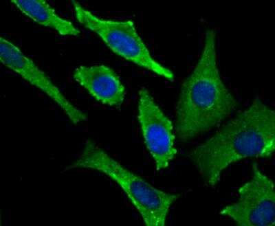 Immunocytochemistry: VAMP-1 Antibody (JG40-19) [NBP2-76877] - ICC staining VAMP1 in SH-SY-5Y cells (green). The nuclear counter stain is DAPI (blue). Cells were fixed in paraformaldehyde, permeabilised with 0.25% Triton X100/PBS.