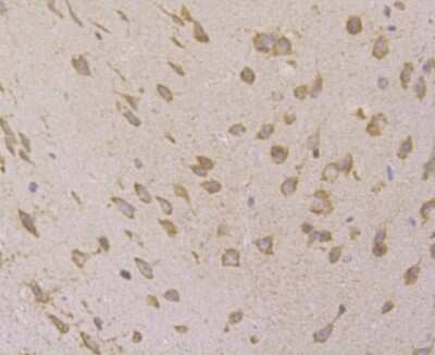 Immunohistochemistry-Paraffin: VAMP-1 Antibody (JG40-19) [NBP2-76877] - Analysis of mouse brain tissue using anti-VAMP1 antibody. Counter stained with hematoxylin.