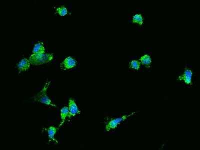 Immunocytochemistry/Immunofluorescence: VAMP-2 Antibody [NBP2-99076] - Immunofluorescence staining of VAMP-2 in U87MG cells. Cells were fixed with 4% PFA, permeabilzed with 0.3% Triton X-100 in PBS, blocked with 10% serum, and incubated with rabbit anti-human VAMP-2 polyclonal antibody (1:1000) at 4C overnight. Then cells were stained with the Alexa Fluor(R)488-conjugated Goat Anti-rabbit IgG secondary antibody (green) and counterstained with DAPI (blue). Positive staining was localized to cytoplasm.
