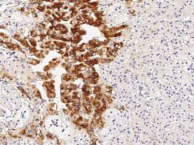 Immunohistochemistry-Paraffin: VAMP-2 Antibody [NBP2-99076] - Immunochemical staining of human VAMP-2 in human adrenal gland with rabbit polyclonal antibody (1:1000, formalin-fixed paraffin embedded sections).