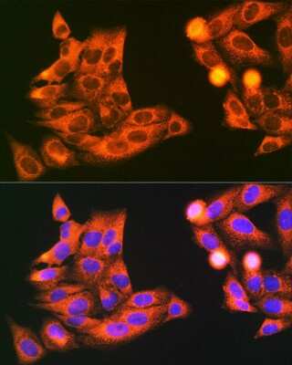 Immunocytochemistry/Immunofluorescence: VAMP-7 Antibody [NBP3-15595] - Immunofluorescence analysis of U2OS cells using VAMP-7 antibody (NBP3-15595) at dilution of 1:100. Blue: DAPI for nuclear staining.