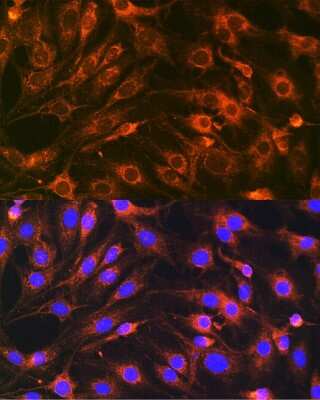 Immunocytochemistry/Immunofluorescence: VAMP-7 Antibody [NBP3-15595] - Immunofluorescence analysis of C6 cells using VAMP-7 antibody (NBP3-15595) at dilution of 1:100. Blue: DAPI for nuclear staining.