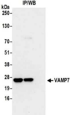 Immunoprecipitation: VAMP-7 Antibody [NBP2-32232] - Samples:  Whole cell lysate (0.5 or 1.0 mg per IP reaction; 20% of IP loaded) from 293T cells. Antibodies:  Affinity purified rabbit anti-VAMP7 antibody NBP2-32232 used for IP at 6 ug per reaction.  VAMP7 was also immunoprecipitated by rabbit anti-VAMP7 antibody BL16273.  For blotting immunoprecipitated VAMP7, NBP2-32232 was used at 1 ug/ml.  Detection: Chemiluminescence with an exposure time of 10 seconds.