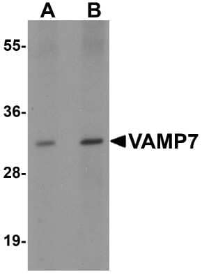 Western Blot: VAMP-7 Antibody [NBP2-41183] - Analysis of VAMP7 in mouse lung tissue lysate with VAMP7 antibody at (A) 0.5 and (B) 1 ug/mL.