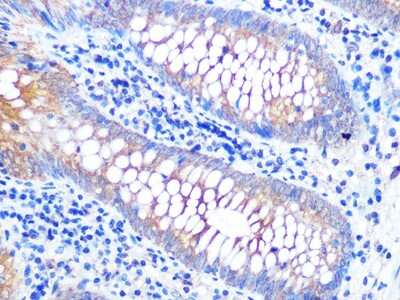 Immunohistochemistry-Paraffin: VAMP-8 Antibody (5H9S4) [NBP3-16471] - Immunohistochemistry of paraffin-embedded human appendix using VAMP-8 Rabbit mAb (NBP3-16471) at dilution of 1:100 (40x lens).Perform microwave antigen retrieval with 10 mM PBS buffer pH 7.2 before commencing with IHC staining protocol.