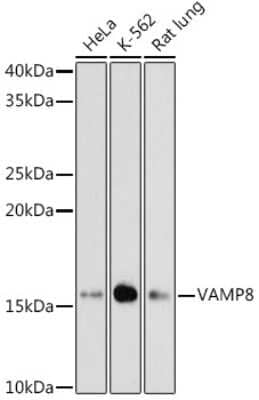 Western Blot: VAMP-8 Antibody (5H9S4) [NBP3-16471] - Western blot analysis of extracts of various cell lines, using VAMP-8 antibody (NBP3-16471) at 1:1000 dilution. Secondary antibody: HRP Goat Anti-Rabbit IgG (H+L) at 1:10000 dilution. Lysates/proteins: 25ug per lane. Blocking buffer: 3% nonfat dry milk in TBST. Detection: ECL Basic Kit. Exposure time: 180s.