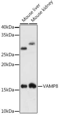 Western Blot: VAMP-8 Antibody (5H9S4) [NBP3-16471] - Western blot analysis of extracts of various cell lines, using VAMP-8 antibody (NBP3-16471) at 1:1000 dilution. Secondary antibody: HRP Goat Anti-Rabbit IgG (H+L) at 1:10000 dilution. Lysates/proteins: 25ug per lane. Blocking buffer: 3% nonfat dry milk in TBST. Detection: ECL Enhanced Kit. Exposure time: 180s.