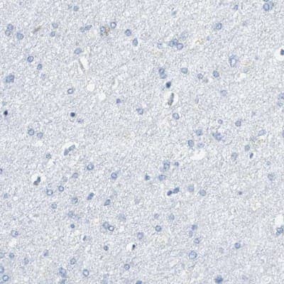 Immunohistochemistry-Paraffin: VAMP-8 Antibody [NBP1-84013] - Staining of human cerebral cortex shows low expression as expected.