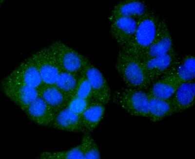 Immunocytochemistry/Immunofluorescence: VAMP-8 Antibody (JF0963) [NBP2-66777] - Staining VAMP8 in Hela cells (green). The nuclear counter stain is DAPI (blue). Cells were fixed in paraformaldehyde, permeabilised with 0.25% Triton X100/PBS.