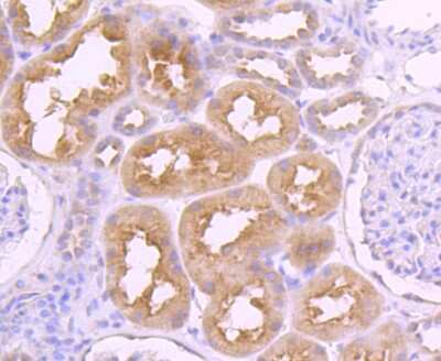 Immunohistochemistry-Paraffin: VAMP-8 Antibody (JF0963) [NBP2-66777] - Analysis of paraffin-embedded human kidney tissue using anti-VAMP8 antibody. Counter stained with hematoxylin.