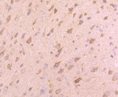 Immunohistochemistry-Paraffin: VAMP-8 Antibody (JF0963) [NBP2-66777] - Analysis of paraffin-embedded mouse brain tissue using anti-VAMP8 antibody. Counter stained with hematoxylin.