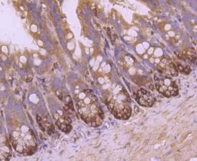 Immunohistochemistry-Paraffin: VAMP-8 Antibody (JF0963) [NBP2-66777] - Analysis of paraffin-embedded mouse colon tissue using anti-VAMP8 antibody. Counter stained with hematoxylin.