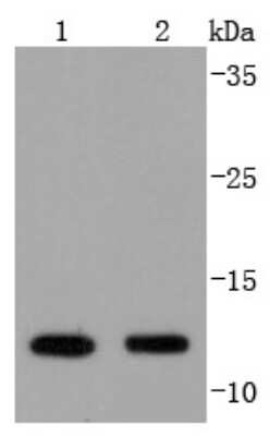 Western Blot: VAMP-8 Antibody (JF0963) [NBP2-66777] - Analysis of VAMP8 on different lysates using anti-VAMP8 antibody at 1/1,000 dilution. Positive control: Lane 1: Hela Lane 2: Mouse kidney