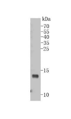 Western Blot: VAMP-8 Antibody (JF0963) [NBP2-66777] - Western blot analysis of VAMP-8 on U93 cell lysates using anti-VAMP-8 antibody at 1/500 dilution.