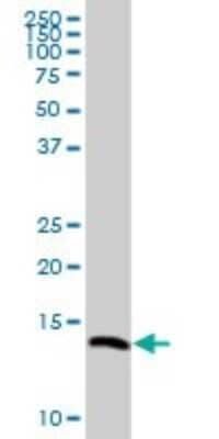 Western Blot: VAMP-8 Antibody [H00008673-B01P] - Analysis of VAMP8 expression in A-431.