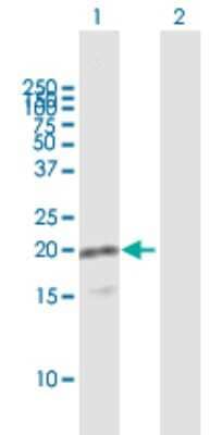 Western Blot: VAMP-8 Antibody [H00008673-B03P] - Analysis of VAMP8 expression in transfected 293T cell line. Lane 1: VAMP8 transfected lysate (11.00 KDa). Lane 2: Non-transfected lysate.
