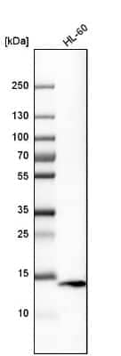 <b>Orthogonal Strategies Validation. </b>Western Blot: VAMP-8 Antibody [NBP1-84013] - Analysis in human cell line HL-60.