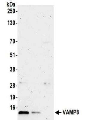 Western Blot: VAMP-8 Antibody [NBP2-32095] - Samples:  Whole cell lysate (50 ug) from HeLa, 293T, and Jurkat cells.  Antibodies:  Affinity purified rabbit anti-VAMP8 antibody NBP2-32095 used for WB at 0.4 ug/ml.  Detection: Chemiluminescence with an exposure time of 3 minutes.