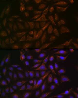 Immunocytochemistry/Immunofluorescence: VAMP3/Cellubrevin Antibody (2H8R8) [NBP3-16705] - Immunofluorescence analysis of U-2 OS cells using VAMP3/VAMP3/Cellubrevin Rabbit mAb (NBP3-16705) at dilution of 1:100 (40x lens). Blue: DAPI for nuclear staining.