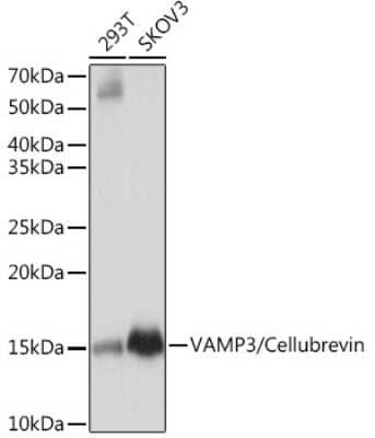 Western Blot: VAMP3/Cellubrevin Antibody (2H8R8) [NBP3-16705] - Analysis of extracts of various cell lines, using VAMP3/VAMP3/Cellubrevin Rabbit mAb (NBP3-16705) at 1:1000 dilution. Secondary antibody: HRP Goat Anti-Rabbit IgG (H+L) at 1:10000 dilution. Lysates/proteins: 25ug per lane. Blocking buffer: 3% nonfat dry milk in TBST. Detection: ECL Basic Kit. Exposure time: 1s.