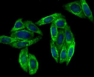 Immunocytochemistry/Immunofluorescence: VAMP3/Cellubrevin Antibody (JG36-31) [NBP2-76983] - ICC staining Cellubrevin in SiHa cells (green). The nuclear counter stain is DAPI (blue). Cells were fixed in paraformaldehyde, permeabilised with 0.25% Triton X100/PBS.