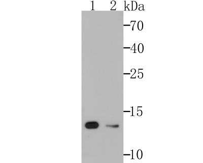 Western Blot: VAMP3/Cellubrevin Antibody (JG36-31) [NBP2-76983] - Western blot analysis of Cellubrevin on A549 (1), 293T(2) cell lysates using anti-Cellubrevin antibody at 1/1,000 dilution.