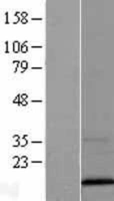 Western Blot: VAMP3/Cellubrevin Overexpression Lysate (Adult Normal) [NBL1-17688] Left-Empty vector transfected control cell lysate (HEK293 cell lysate); Right -Over-expression Lysate for VAMP3/Cellubrevin.