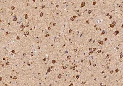 Immunohistochemistry-Paraffin: VAMP4 Antibody [NBP3-05918] - Staining of human VAMP4 in human brain with rabbit polyclonal antibody at 1:100 dilution.
