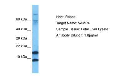 Western Blot: VAMP4 Antibody [NBP2-83746] - WB Suggested Anti-VAMP4 antibody Titration: 1 ug/mL. Sample Type: Human Fetal Liver