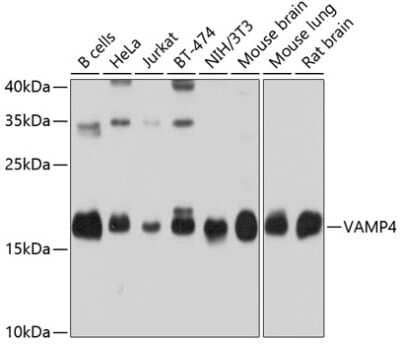 Western Blot: VAMP4 Antibody [NBP2-94885] - Analysis of extracts of various cell lines, using VAMP4 at 1:1000 dilution. Secondary antibody: HRP Goat Anti-Rabbit IgG (H+L) at 1:10000 dilution. Lysates/proteins: 25ug per lane. Blocking buffer: 3% nonfat dry milk in TBST. Detection: ECL Basic Kit . Exposure time: 10s.