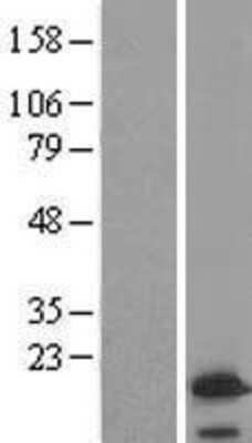 Western Blot: VAMP4 Overexpression Lysate (Adult Normal) [NBL1-17689] Left-Empty vector transfected control cell lysate (HEK293 cell lysate); Right -Over-expression Lysate for VAMP4.