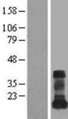 Western Blot: VAMP5 Overexpression Lysate (Adult Normal) [NBL1-17690] Left-Empty vector transfected control cell lysate (HEK293 cell lysate); Right -Over-expression Lysate for VAMP5.