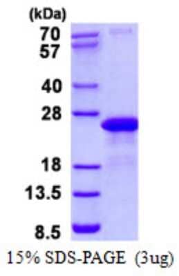 SDS-Page: VAMP7 Protein [NBP2-22939]