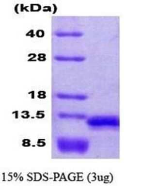 SDS-PAGE Recombinant Human VAMP-8 His Protein