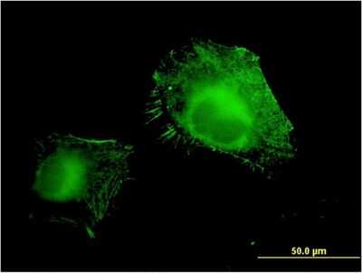 Immunocytochemistry/Immunofluorescence: VAP-1/AOC3 Antibody (4B8) [H00008639-M06] - Analysis of monoclonal antibody to AOC3 on HeLa cell. Antibody concentration 10 ug/ml
