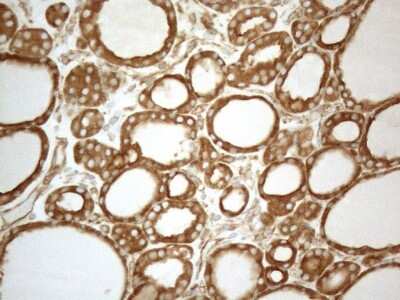 Immunohistochemistry: VAP-A Antibody (10E10) [NBP2-46319] - Analysis of Human thyroid tissue. (Heat-induced epitope retrieval by 1mM EDTA in 10mM Tris buffer (pH8.5) at 120C for 3 min)